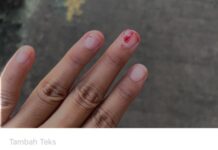 “Diduga Tak Bela Karyawan, Ketua Serikat Pekerja PT. Multi Indomandiri (MIM) Karawang Bungkam Soal Ganti Rugi Kecelakaan Kerja Empat Bulan Belum Di Bayar,”