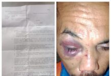 Kasus Pengeroyokan Warga di Banggai Laut Melibat Anggota Polri: Polres Mulai Usut Terlapor